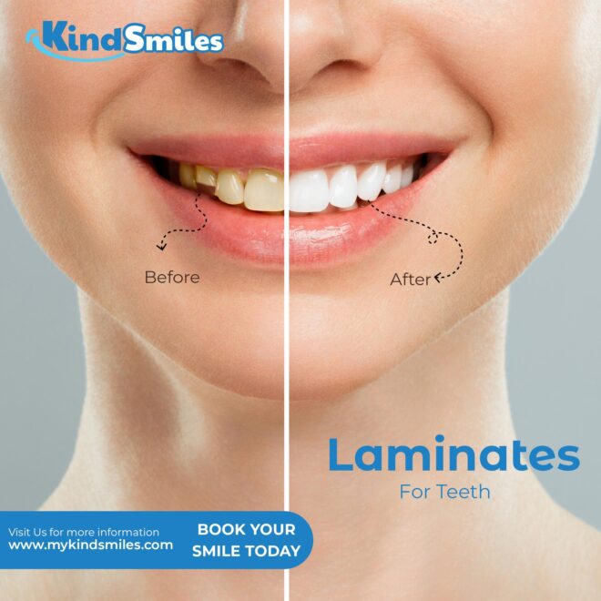 Kind Smiles Dental Clinic - Social Media Marketing SMM service in Hyderabad and India (4)