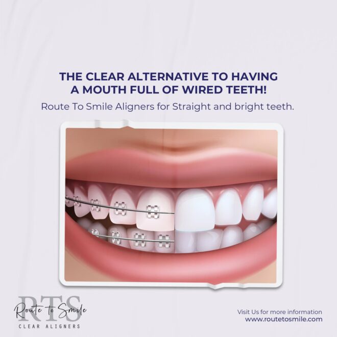 Route To Smile - Social Media Marketing SMM service in Hyderabad and India (3)