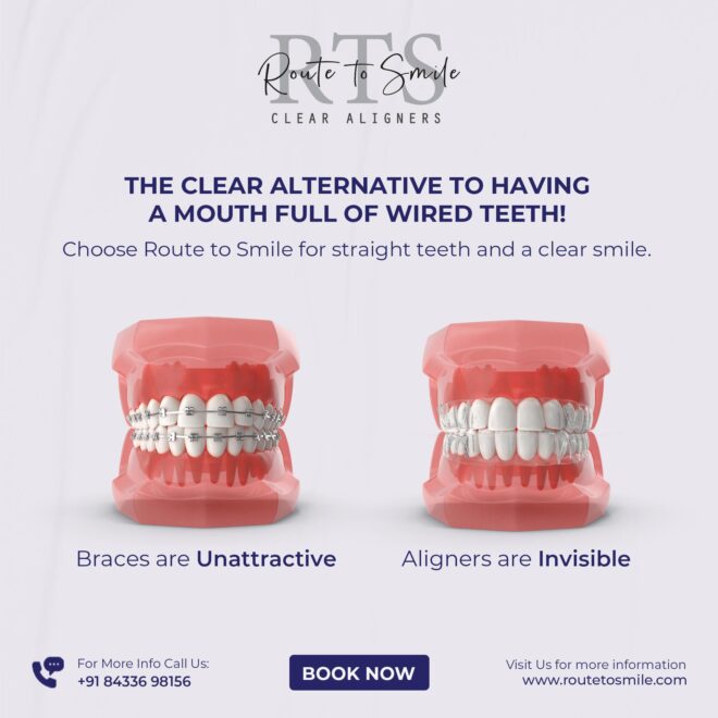 Route To Smile - Social Media Marketing SMM service in Hyderabad and India (5)